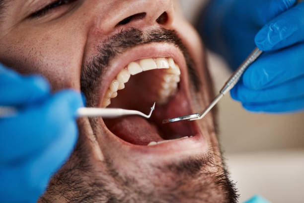 Best 24-Hour Emergency Dental Care in Mount Pleasant, IA